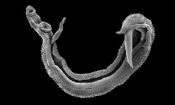 Schistosoma haematobium